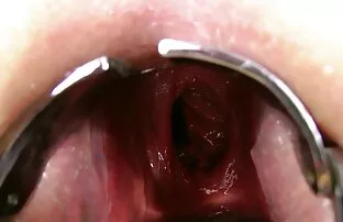 XXX Kinkynikky להאריך XO specul anal סרטוני סקס לצפיה חינם